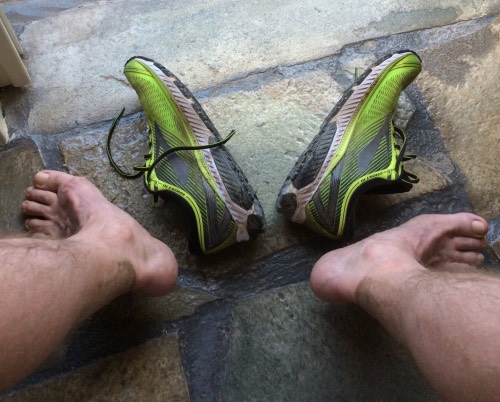 post-race-feet